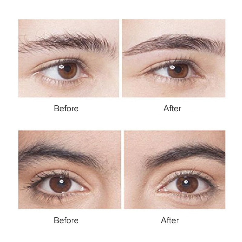 Mini Electric Hair Removal Epilator